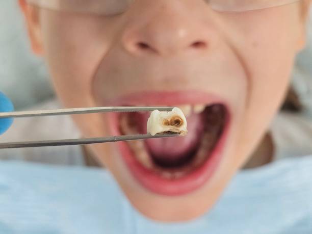 Best Emergency Treatment for Toothache in Pine Lake Park, NJ
